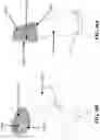 Fig. 46 - SCRAPE AND SWEEP FRICTIONAL TISSUE SAMPLING AND COLLECTION METHOD AND DEVICE