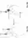 Fig. 49 - SCRAPE AND SWEEP FRICTIONAL TISSUE SAMPLING AND COLLECTION METHOD AND DEVICE
