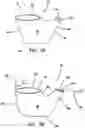 Fig. 08 - Systems and methods for tissue containment and retrieval