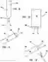 Fig. 16 - Systems and methods for tissue containment and retrieval