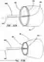 Fig. 28 - Systems and methods for tissue containment and retrieval