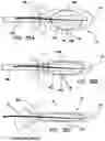 Fig. 30 - Systems and methods for tissue containment and retrieval