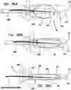 Fig. 31 - Systems and methods for tissue containment and retrieval