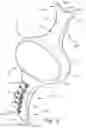 Fig. 10 - Tongue elevator device