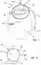 Fig. 02 - TISSUE REMOVAL CONTAINMENT SYSTEMS