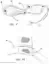 Fig. 05 - TISSUE REMOVAL CONTAINMENT SYSTEMS