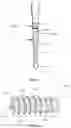 Fig. 02 - Suture anchor with biologic proximal end