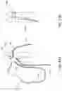 Fig. 31 - Automatically reloading suture passer devices and methods