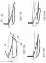 Fig. 33 - Automatically reloading suture passer devices and methods