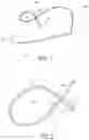 Fig. 02 - Reinforced graft constructs and methods of tissue repairs