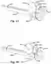 Fig. 06 - Surgical handle assembly modes of operation