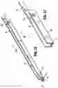 Fig. 13 - Endoscopic stapler