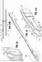 Fig. 14 - Endoscopic stapler