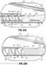 Fig. 20 - Endoscopic stapler