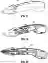 Fig. 06 - Powered surgical tack applier