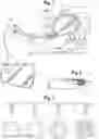 Fig. 02 - Introducer for uterine tamponade assembly with echogenic element and methods of using the same