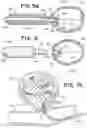 Fig. 05 - Intrasaccular device positioning and deployment system