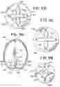 Fig. 07 - Intrasaccular device positioning and deployment system