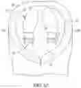 Fig. 12 - Tibial cut guide