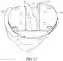 Fig. 13 - Tibial cut guide