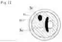 Fig. 10 - Medical device