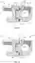 Fig. 10 - Spinal implant connector and methods