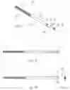 Fig. 04 - METHOD OF BONE FIXATION