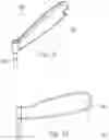 Fig. 16 - METHOD OF BONE FIXATION