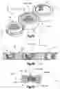Fig. 08 - Bone fixation system