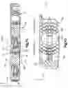Fig. 12 - Bone fixation system
