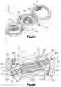Fig. 15 - Bone fixation system