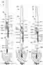 Fig. 07 - Orthopedic break-off screws, tools for inserting such screws, and related systems and methods