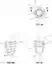 Fig. 03 - Surgical fixation assembly and methods of use