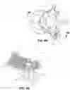 Fig. 05 - Surgical fixation assembly and methods of use