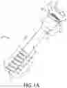 Fig. 02 - Orthopedic implant assemblies and devices