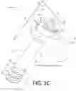 Fig. 14 - Orthopedic implant assemblies and devices