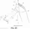 Fig. 15 - Orthopedic implant assemblies and devices