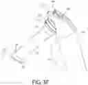 Fig. 17 - Orthopedic implant assemblies and devices
