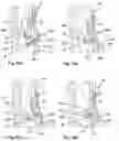 Fig. 10 - Instrument for attaching to a bone anchor and instrument for use in distraction and/or retraction, in particular for orthopedic surgery or neurosurgery, more specifically for spinal surgery