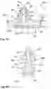 Fig. 15 - Instrument for attaching to a bone anchor and instrument for use in distraction and/or retraction, in particular for orthopedic surgery or neurosurgery, more specifically for spinal surgery