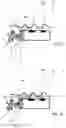 Fig. 03 - Surgical instruments and systems with multimodes of treatments and electrosurgical operation