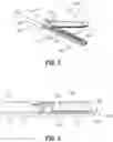 Fig. 03 - Deployment mechanism for surgical instruments