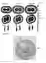Fig. 03 - METHODS OF REDUCING ADVERSE EFFECTS OF NON-THERMAL ABLATION