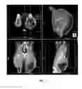 Fig. 04 - METHODS OF REDUCING ADVERSE EFFECTS OF NON-THERMAL ABLATION