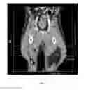 Fig. 05 - METHODS OF REDUCING ADVERSE EFFECTS OF NON-THERMAL ABLATION