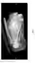 Fig. 07 - METHODS OF REDUCING ADVERSE EFFECTS OF NON-THERMAL ABLATION