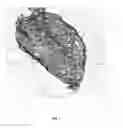 Fig. 08 - METHODS OF REDUCING ADVERSE EFFECTS OF NON-THERMAL ABLATION