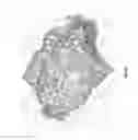 Fig. 11 - METHODS OF REDUCING ADVERSE EFFECTS OF NON-THERMAL ABLATION