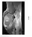 Fig. 26 - METHODS OF REDUCING ADVERSE EFFECTS OF NON-THERMAL ABLATION