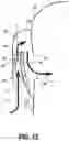 Fig. 13 - Robotic surgical systems and drapes for covering components of robotic surgical systems